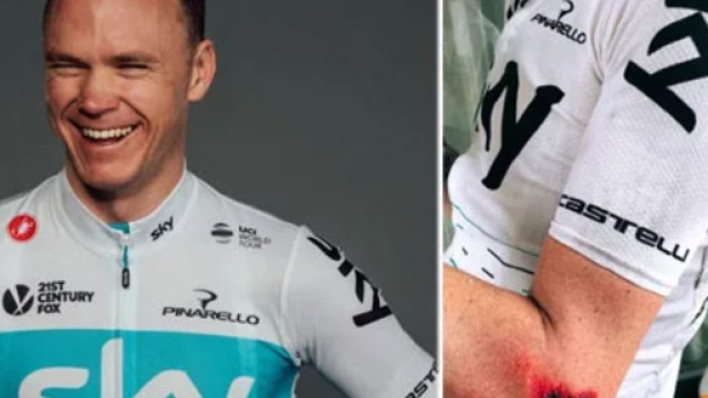 Chris Froome ferito dopo la caduta in allenamento