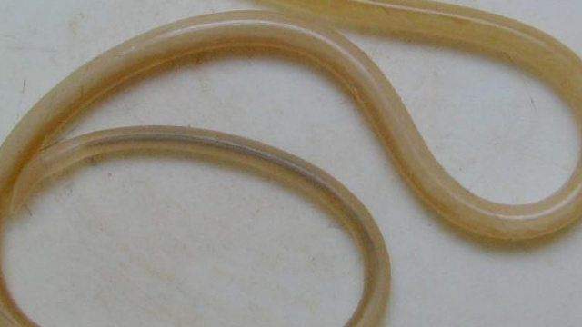 Il parassita che provoca la toxocariosi