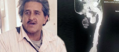 Roberto Esquival, homem que tem o maior p&ecirc;nis do mundo