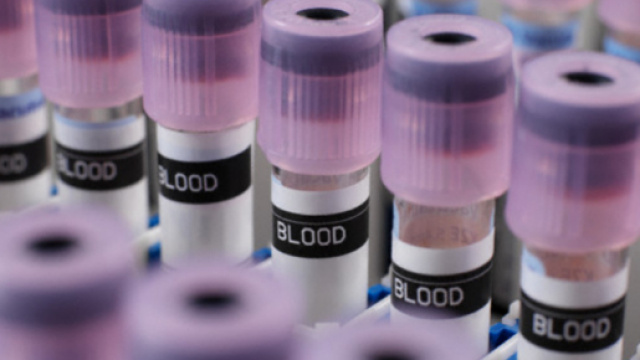 Tumori, la diagnosi precoce passa per gli esami del sangue - Wired - wired.it