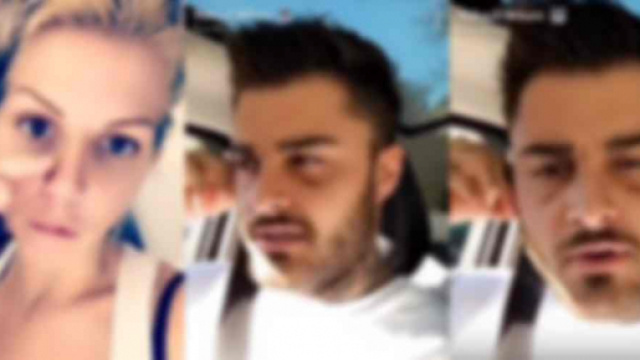 Jessica et Thibault d&eacute;voilent leurs nouveaux visages apr&egrave;s la chirurgie esth&eacute;tique !