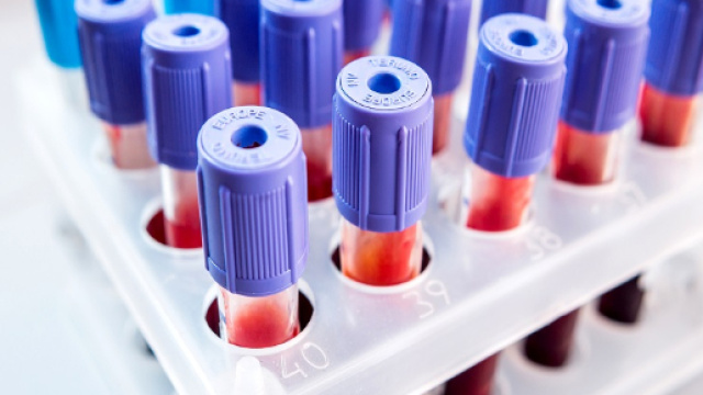 Prelievo ematico per la diagnosi precoce dei tumori: fra non molto sar&agrave; realt&agrave;