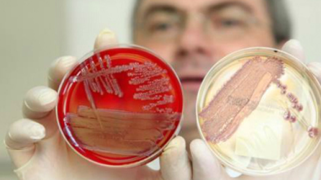 Trapianto di feci per curare pazienti immunodepressi