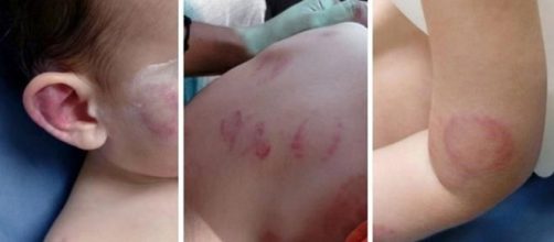 Beb&ecirc; &eacute; brutalmente violentado. (Imagens ilustrativas / Google)