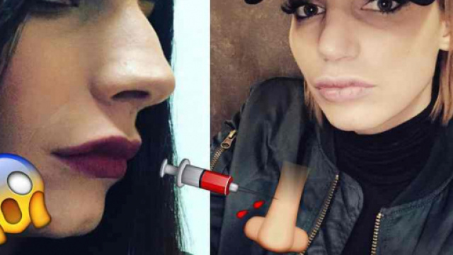 Chirurgie esth&eacute;tique : Nad&egrave;ge Lacroix (La Villa des Coeurs Bris&eacute;s 3) d&eacute;teste son nouveau nez !