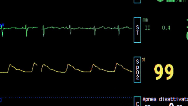Infarto e ictus: scoperto un nuovo pericoloso fattore di rischio da conoscere