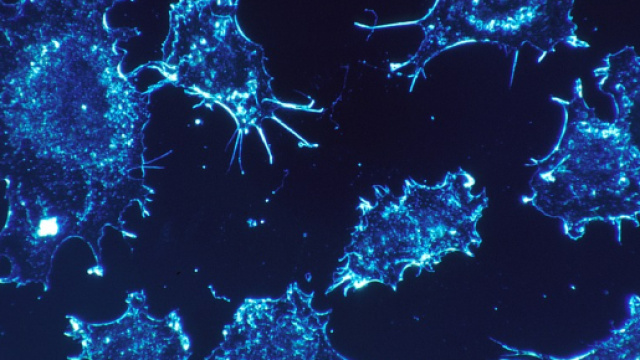 Immagine delle cellule tumorali