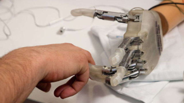 La nuova mano bionica &egrave; made in Italy | Reporter nuovo - reporternuovo.it