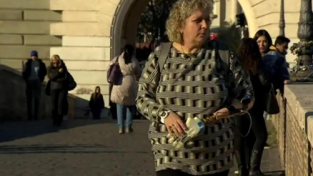 Mano bionica installata a Roma: &egrave; il primo caso italiano - thesun.co.uk