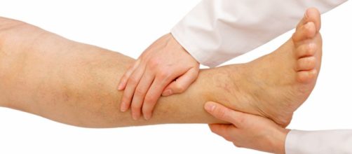 Como eliminar la retenci&oacute;n de l&iacute;quidos de forma natural