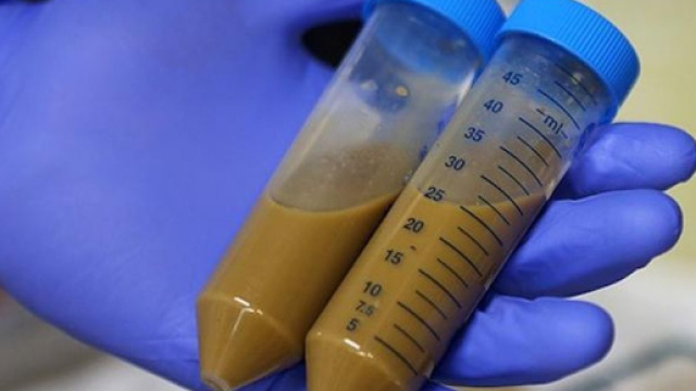 Trapianto di feci contro antibiotico-resistenza: cos'&egrave; - VelvetBody - velvetbody.it