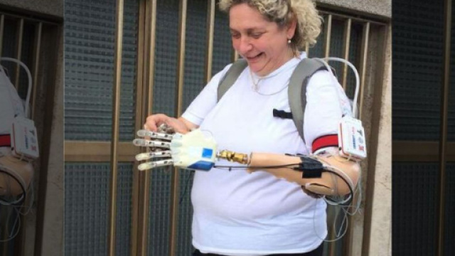 Prima mano bionica installata ad una donna veneta - foxnews.com