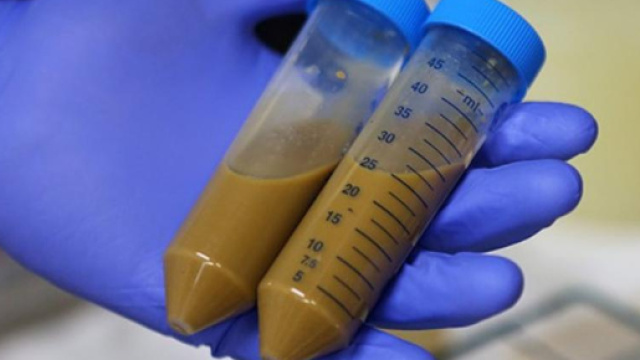 Il trapianto di feci potr&agrave; aiutare a debellare le infezioni incurabili?