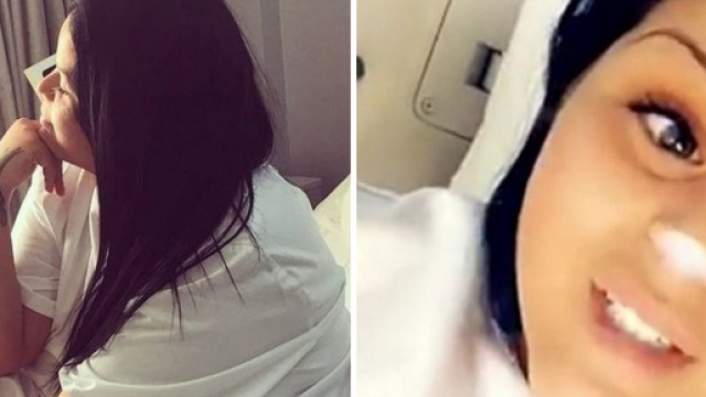 Les 5 chirurgies esth&eacute;tiques les plus surprenantes des candidats de t&eacute;l&eacute; r&eacute;alit&eacute;