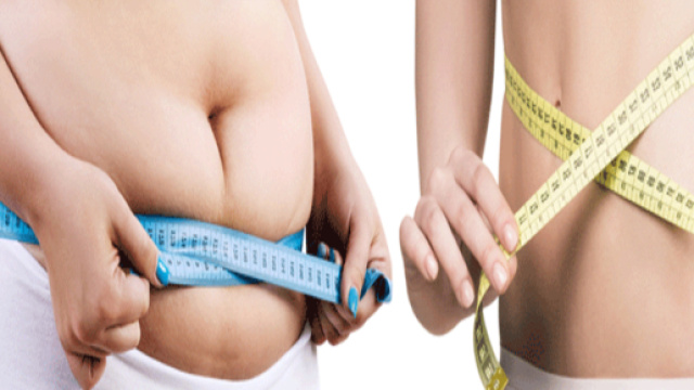 Gran Bretagna: stop ai lifting per avere glutei 'alla brasiliana',