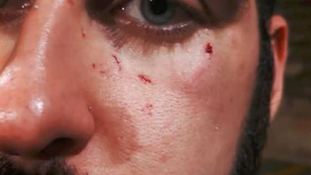 Pisa, picchiati e aggrediti due fidanzati gay