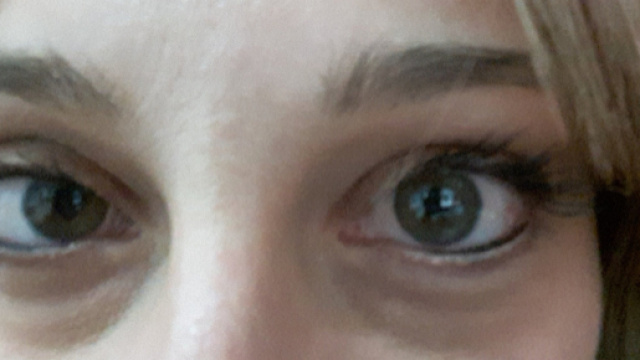 Alcuni rimedi per eliminare le occhiaie.