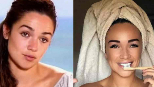 Agac&eacute;e par les rumeurs de chirurgie esth&eacute;tique, Jazz &eacute;num&egrave;re la liste de toutes ses op&eacute;rations.