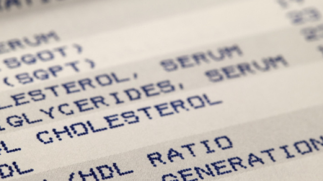 Alcune sane abitudini per abbassare il valore dei trigliceridi.