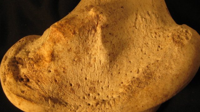 Alcuni consigli per prevenire l'osteoporosi.