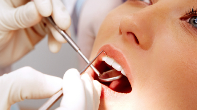 Trovata associazione tra problemi dentali e sindrome dell'ovaio policistico