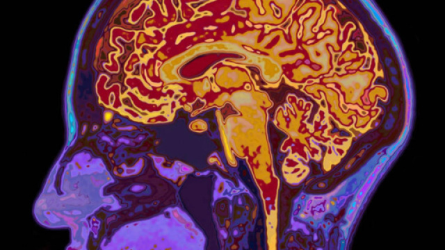 Il cervello 'continua' a funzionare anche dopo la morte, l'ipotesi di un esperto