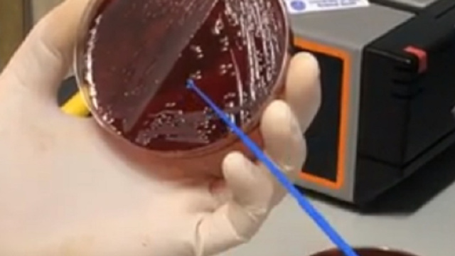 Stafilococco, il batterio che pu&ograve; diventare letale