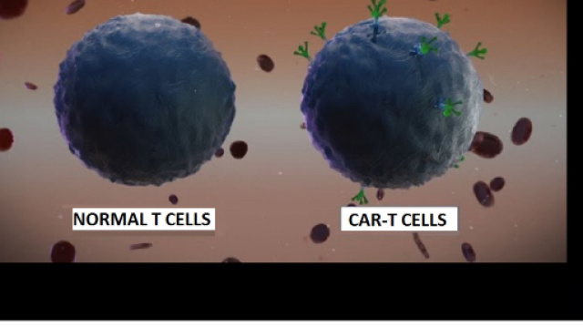 Moderne terapie con anticorpi monoclonali e terapie cellulari CAR-T stanno dando importanti risultati nella lotta contro il mieloma multiplo