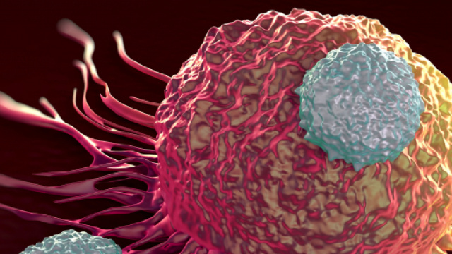 Le cellule CAR-T contrastano il mieloma multiplo