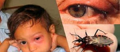 Las zoonosis parasitarias afectan a ni&ntilde;os, adultos y ancianos, y muchas veces son subregistradas