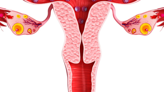 Alcuni sintomi della presenza di cisti ovariche.