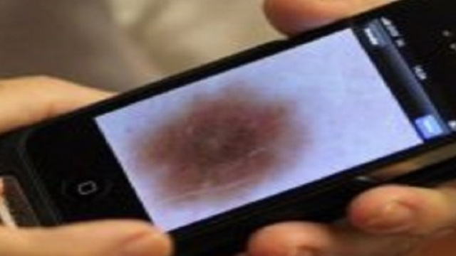 Treviso: Donna scopre di avere un tumore grazie allo smartphone