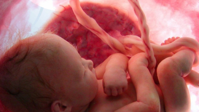 Primo caso al mondo di bambina nata da un utero di donna deceduta