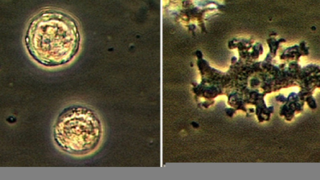 Balamuthia mandrillaris, l'ameba mangia cervello responsabile della morte di una donna