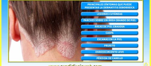 Como tratar la dermatitis seborreica de forma natural