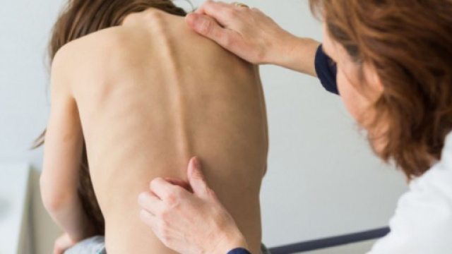 VID&Eacute;O. R&eacute;volution : comme un appareil dentaire... pour le dos ... - sciencesetavenir.fr