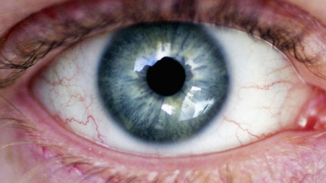 Giovane 27enne aveva 14 vermi in un occhio: ecco cos'&egrave; accaduto.