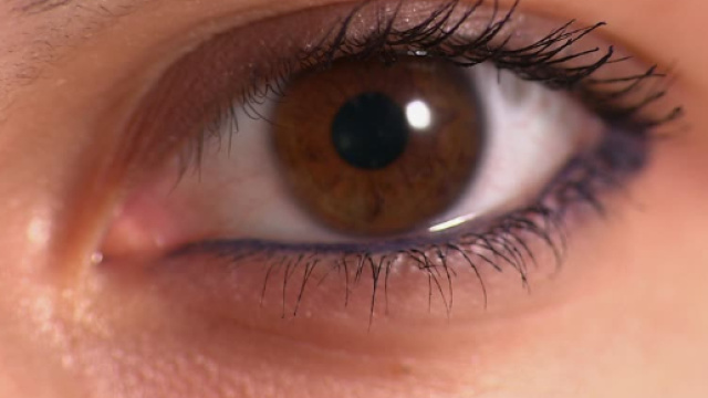 Prelevati 14 vermi dall'occhio di una donna: ecco cosa &egrave; accaduto