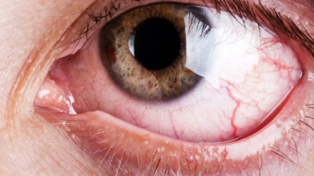 L'Occhio Rosso - occhioallaretina.it