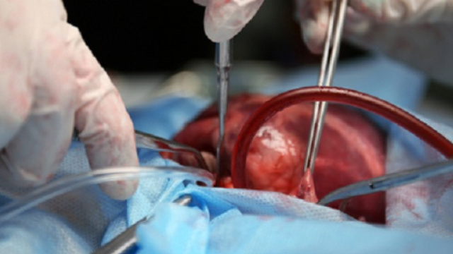 Uomo vive con due cuori. Eccezionale trapianto in India