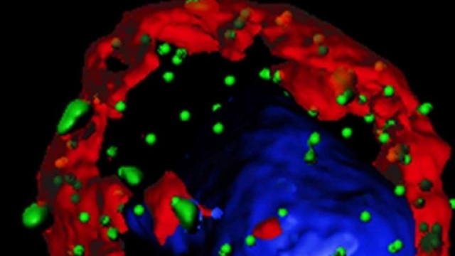 Primo bimbo guarito da leucemia con sue cellule &laquo;riprogrammate&raquo; - avvenire.it