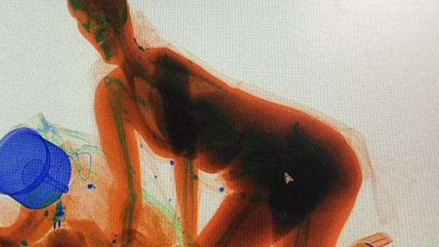 La donna all'interno dell'apparecchio a raggi X