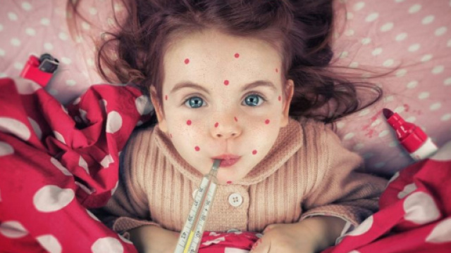 Vaccino contro il morbillo: quando si fa e perch&eacute; &egrave; importante - gioia.it