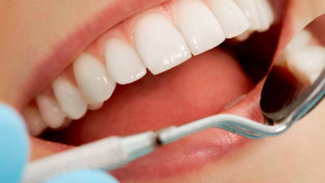 Carie ai denti? pu&ograve; causare danni al cuore