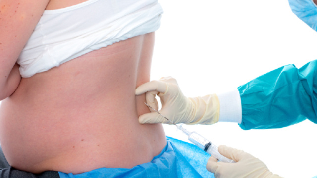 Epidurale: &egrave; un diritto delle donne in gravidanza