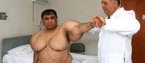 peruano que sufre una extra&ntilde;a enfermedad