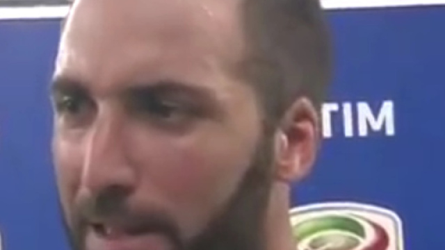 Higuain in dubbio per la partita di Coppa Italia.