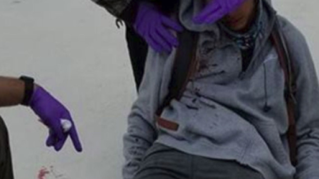 Usa, disabile pestato a scuola dai bulli: immagini shock