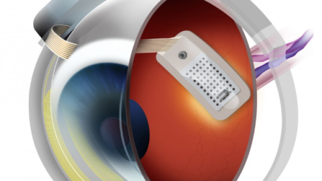 Ecco la retina artificiale che rid&agrave; la vista ai ciechi - Panorama - panorama.it
