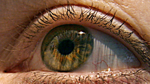 Retina artificiale restituisce la vista ad una donna cieca: i dettagli
